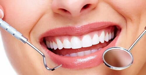 علاج تسوس الأسنان الأمامية