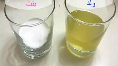 تحليل الكلور للحمل وتغير لون البول