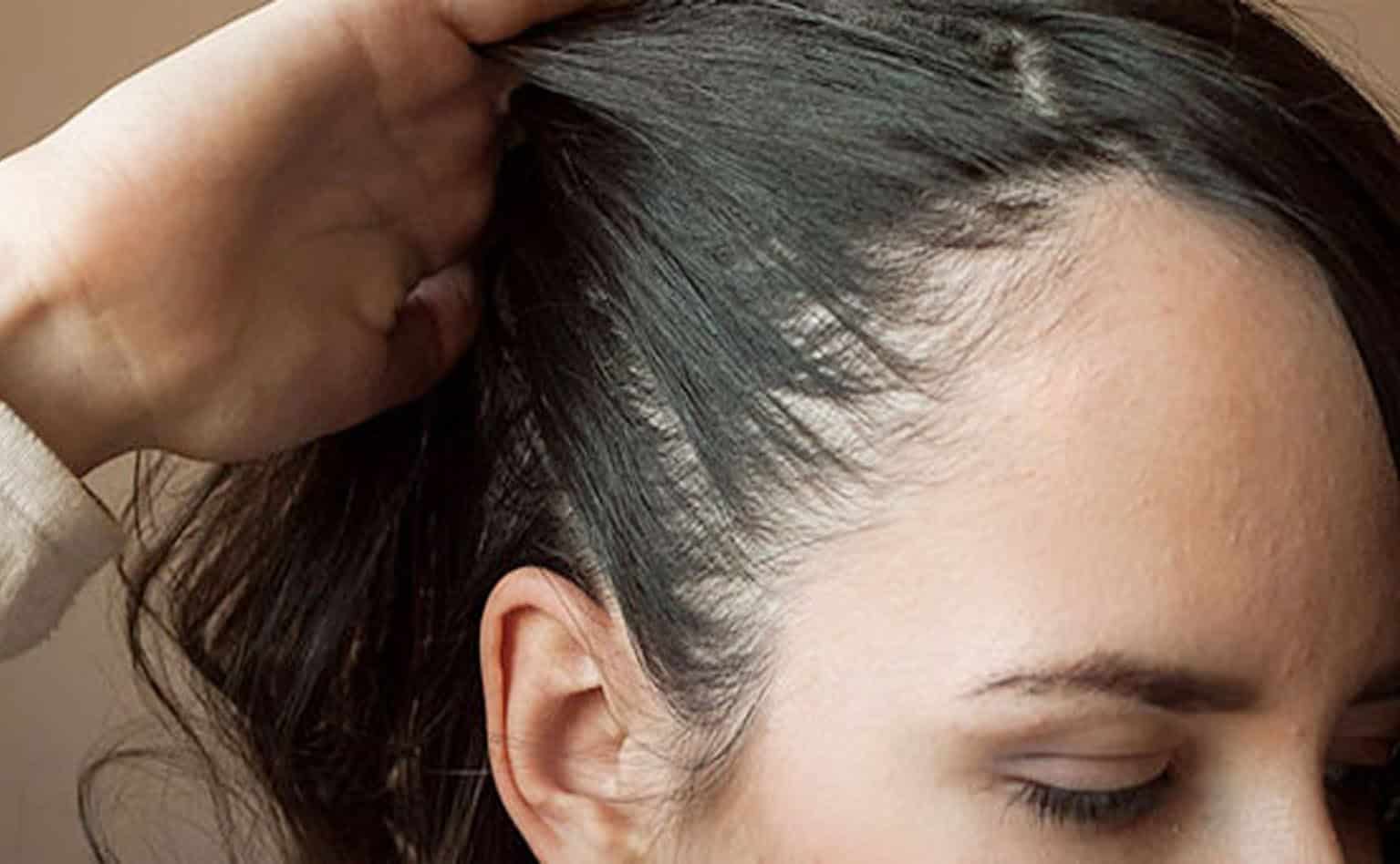 أسباب تساقط الشعر وعلاجه طبيعياً