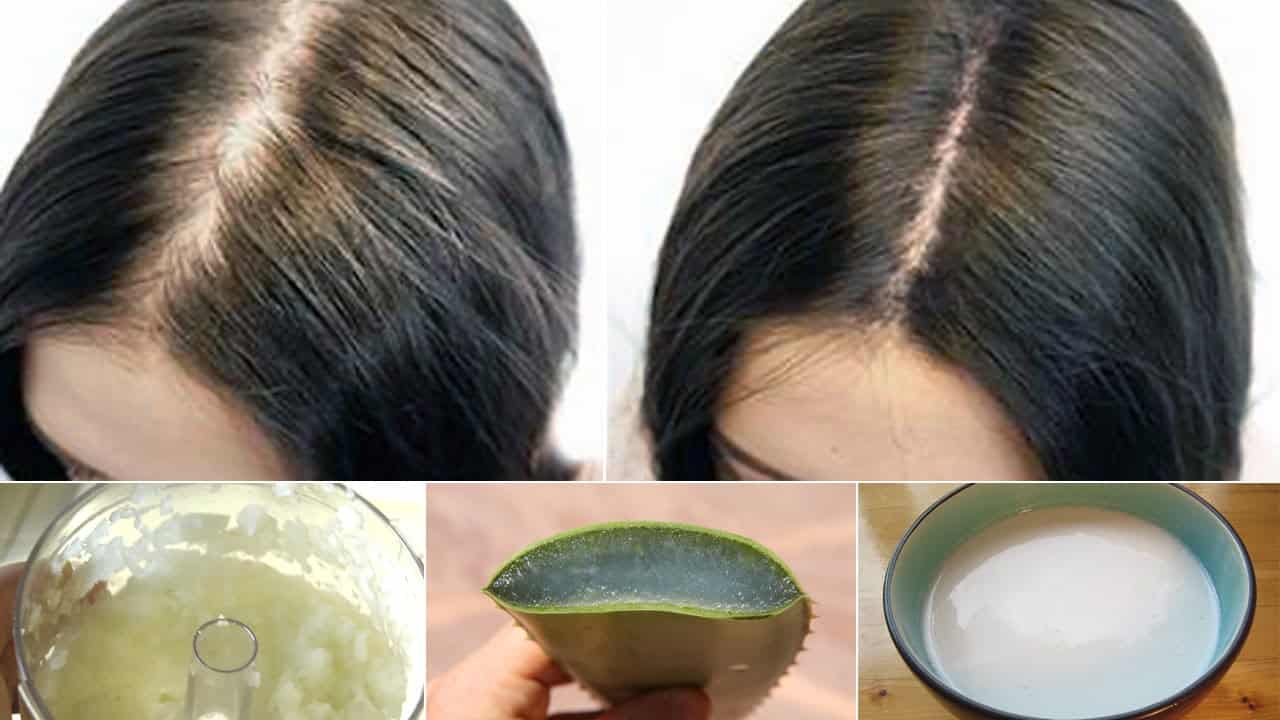 طرق منع تساقط الشعر وتكثيفه
