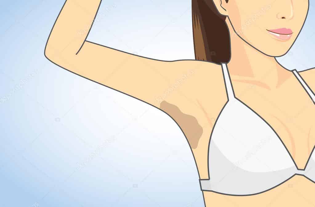 اسباب اسمرار تحت الابط وعلاجه