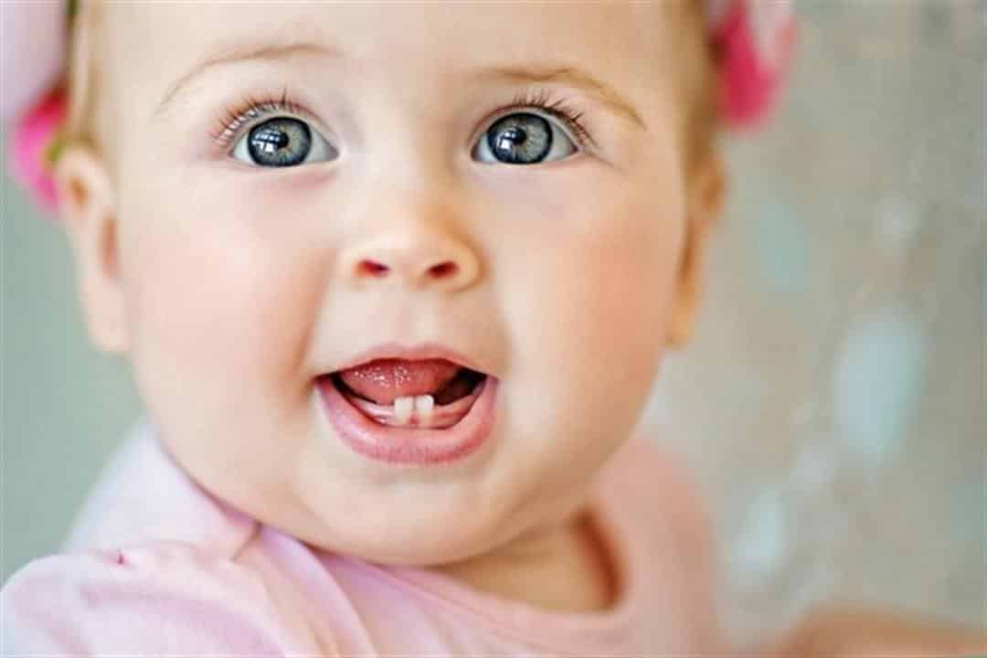 اسباب تأخر التسنين عند الاطفال