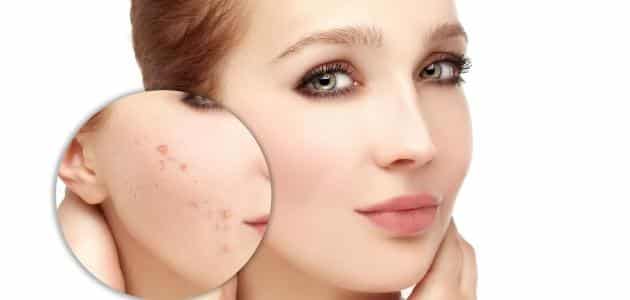 وصفة لتقشير الوجه وتبيضه